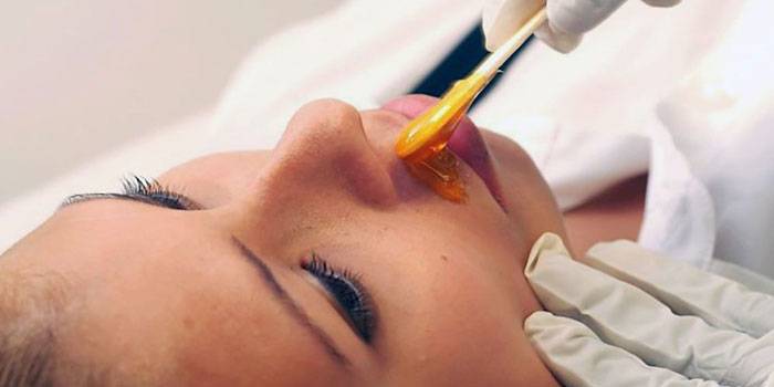 Shugaring facial
