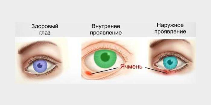 Видове ечемик на век