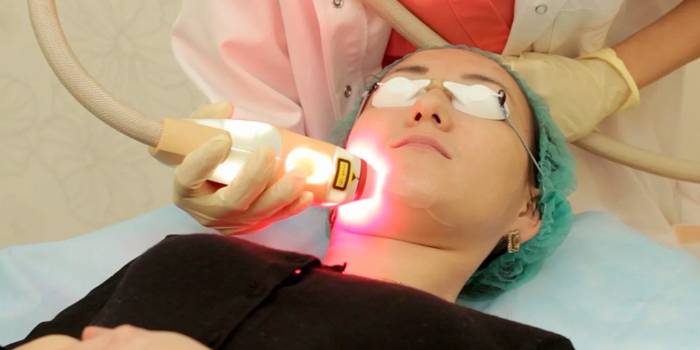 Tratamento com laser