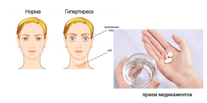 Príčiny výskytu chlpov tváre u žien
