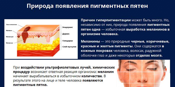 Charakter pojawienia się plam starczych