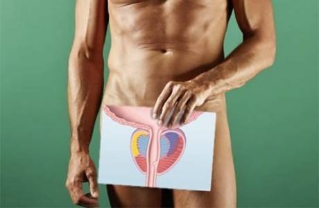 Prostatitis en hombres