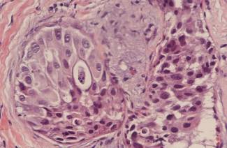 ¿Qué es la histología?