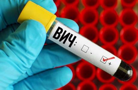Jaka jest różnica między HIV a AIDS?