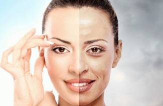 Peeling retinoico