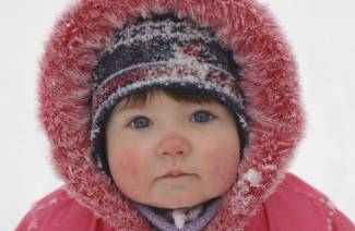 Alergia ao frio