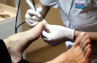 Pedicure medyczny dla grzybów paznokci