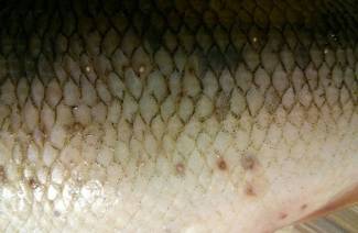 Leczenie opisthorchiasis