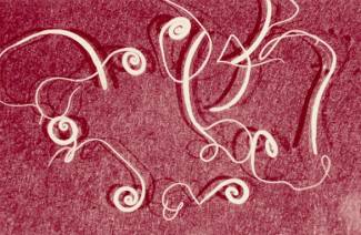 Worm Eggs