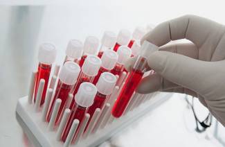 Glykovaný hemoglobín