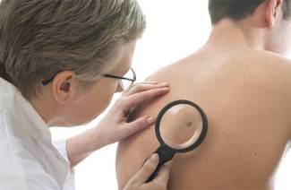¿Qué es el fibroma y cómo tratarlo?