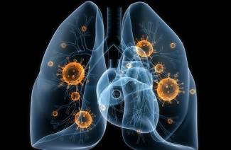 O que é pneumonia?