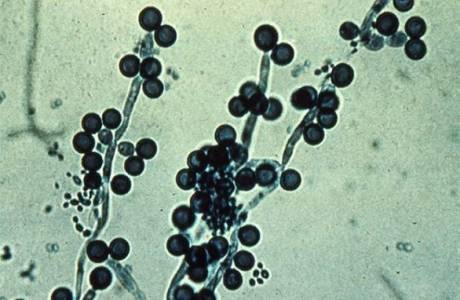Candida Albicans