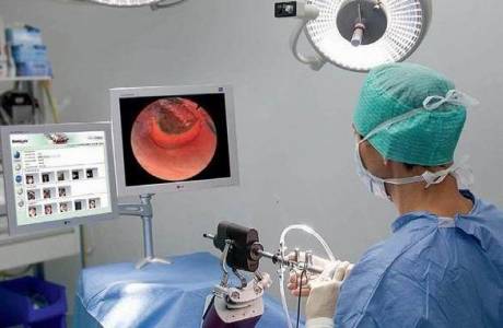 ¿Qué es la histeroscopia uterina?