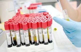 ¿Qué es el estradiol?