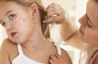 Atypická dermatitída