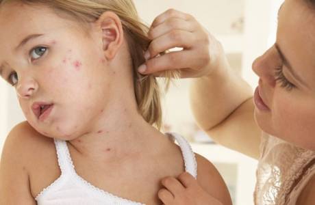 Atypická dermatitída