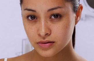 Como remover contusões sob os olhos em casa