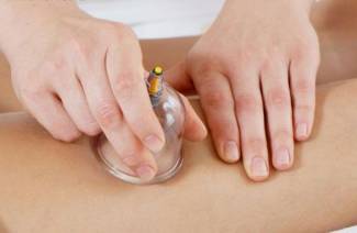 Čo je to hijama