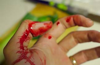 Hemostatické lieky