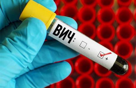 Prevencia HIV