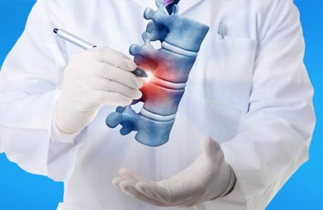 Hemangioma de la columna vertebral
