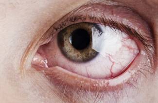 Diabetes Retinopatia