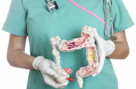 Cáncer de intestino