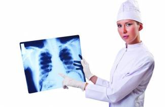 Síntomas y signos de cáncer de pulmón.