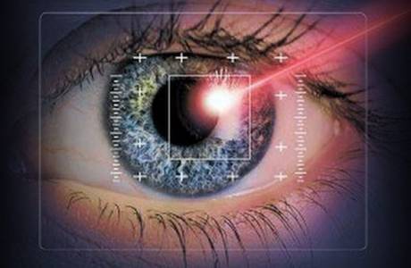 Correção de visão a laser
