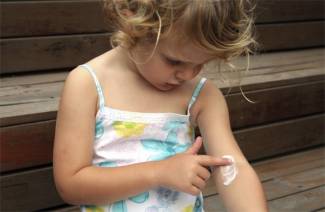 Psoriasis en niños.