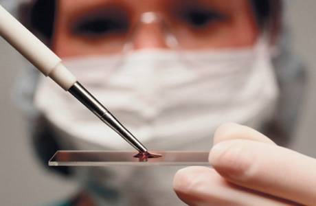 Prueba de azúcar en la sangre