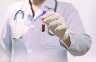 Exame de sangue para álcool