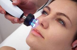 ¿Qué es el lifting facial con RF?