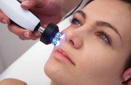 O que é rf face lifting