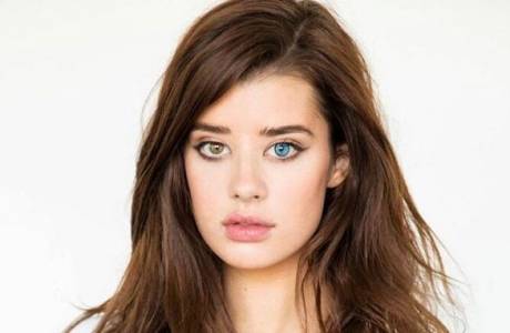 Heterocromia