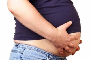 Ascites Ascites
