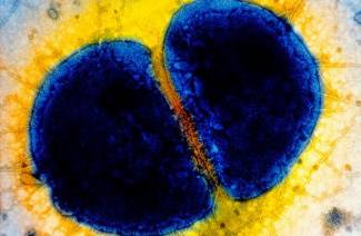 Diplococci