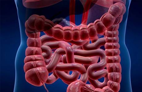 Qual é melhor, colonoscopia ou ressonância magnética intestinal