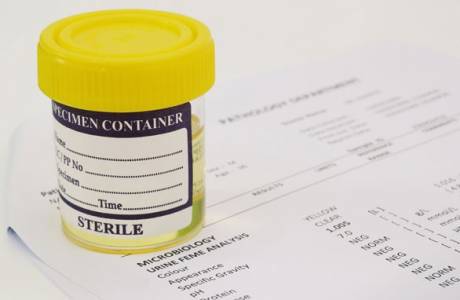 ¿Qué significa proteína en la orina?
