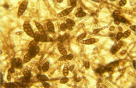 Fungus Alternaria alternata