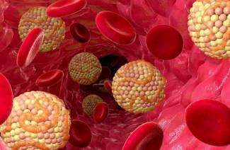 ¿Qué hacer con el colesterol alto en sangre?