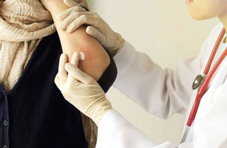 Causas de la neurodermatitis