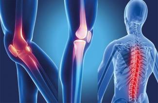 Seronegatívna spondylitída