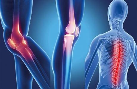 Seronegatívna spondylitída