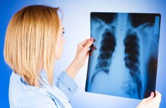 Síntomas y primeros signos de tuberculosis.