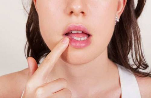 Herpes v ústach