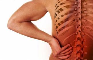 Miechová osteochondróza