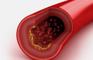 HDL cholesterol