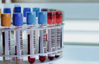 Aumento da bilirrubina no sangue